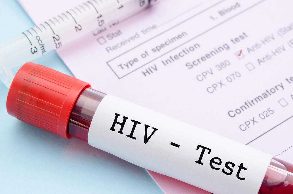 kako prenositi HIV