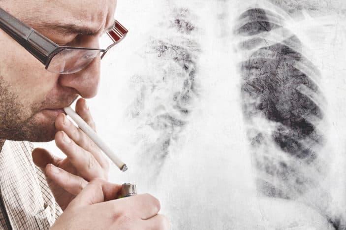 simptomi raka pluća