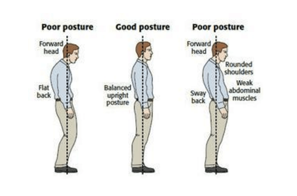 Izvor slike: http://www.thephysiocompany.com/blog/stop-slouching-postural-dysfunction-symptoms-causes-and-treatment-of-bad-posture