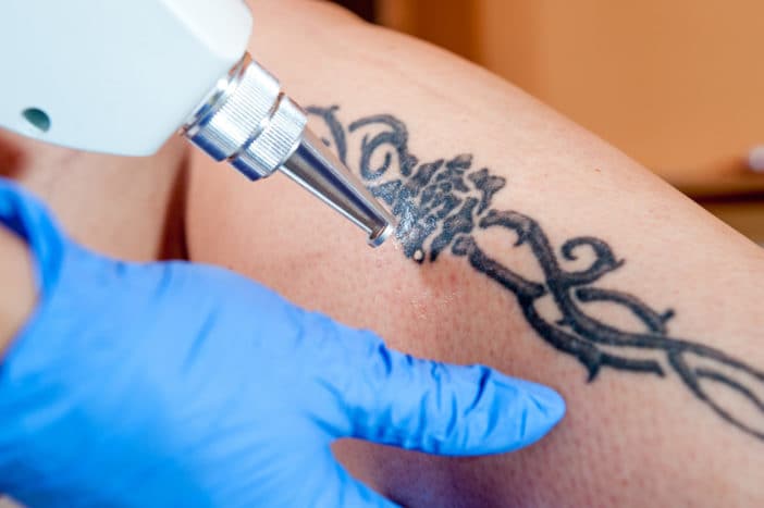opasnost od tetoviranja