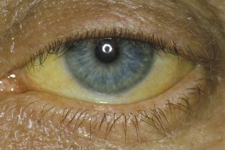 žute oči