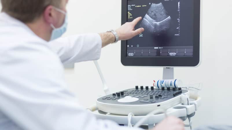 transvaginalni ultrazvučni pregled
