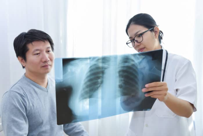 intersticijske bolesti pluća