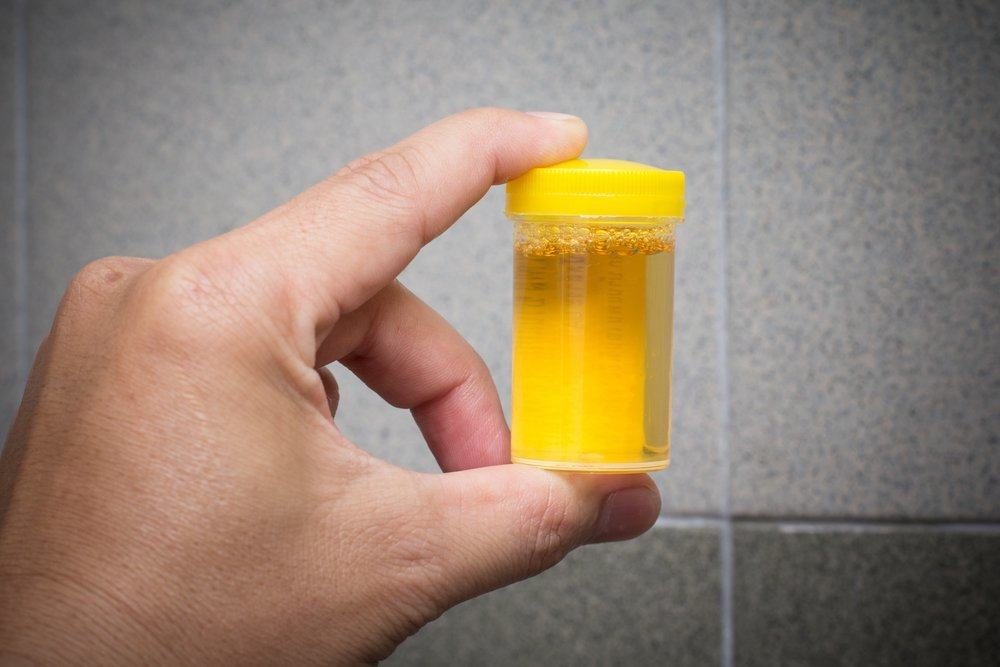 urinskom terapijom piti urin