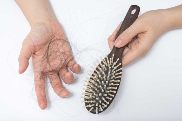 Ćelavost gubitak kose nakon poroda