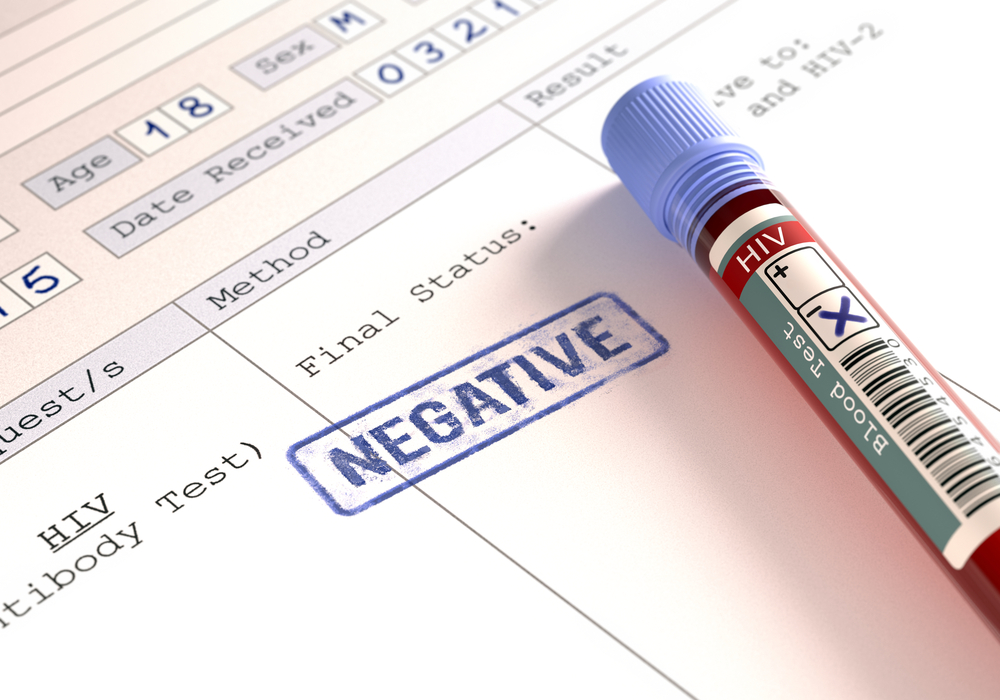 značenje rezultata negativnog HIV testa