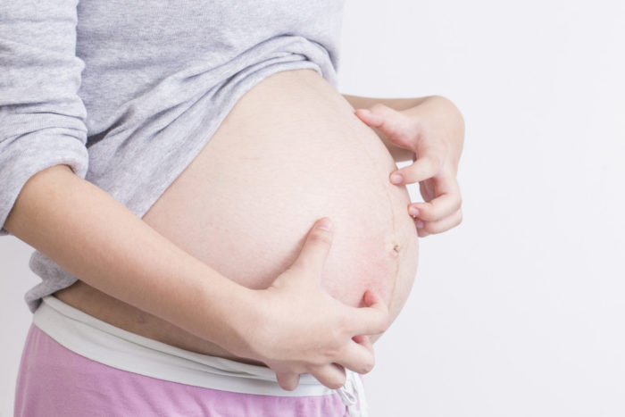 Pruritski folikulitis je uzrok svrbeža kože tijekom trudnoće