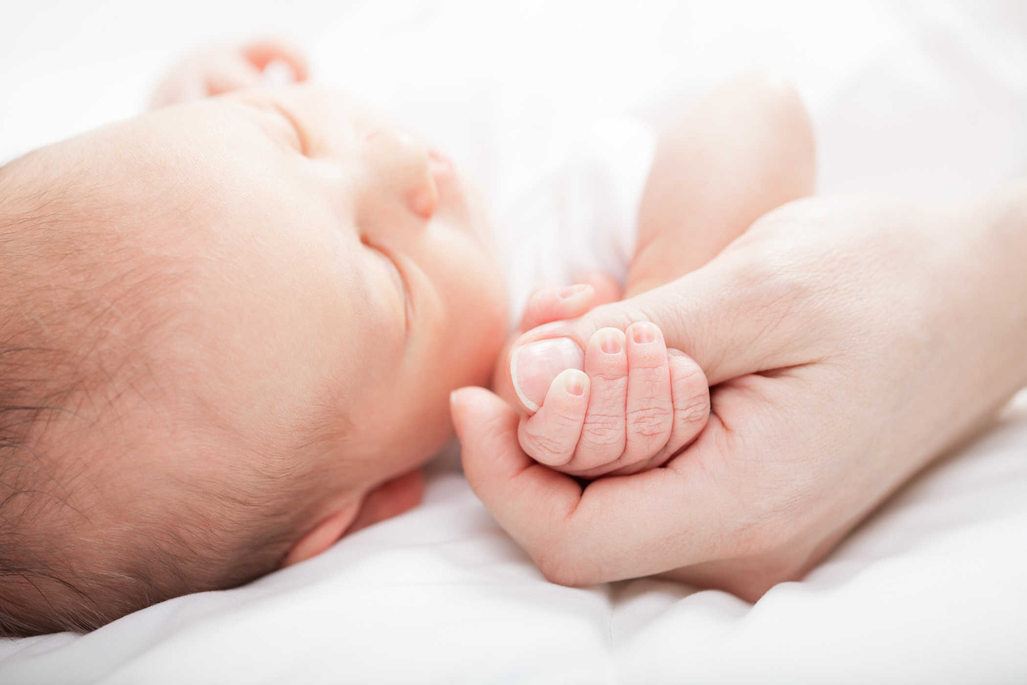 albinizam u dojenčadi